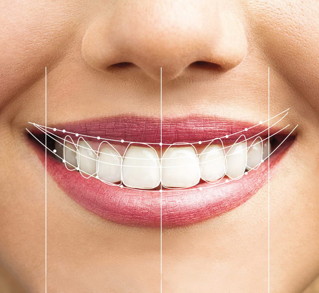 Diseño De Sonrisas La Clínica Facial